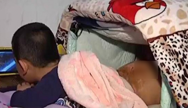 4岁男童跌入热汤锅　下半身水泡脱皮